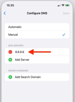 configure dns